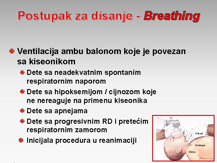 Postupak za disanje - Breathing Ventilacija ambu balonom koje je povezan sa kiseonikom Dete
