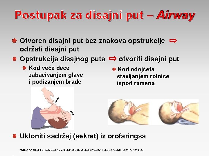 Postupak za disajni put – Airway Otvoren disajni put bez znakova opstrukcije održati disajni