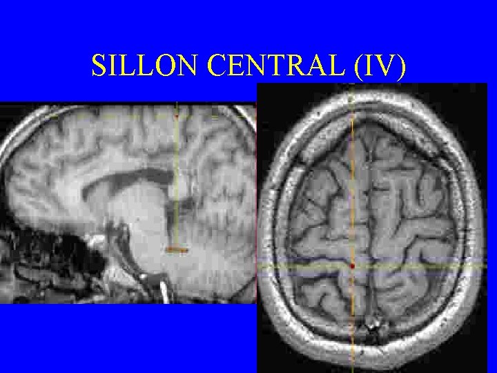 SILLON CENTRAL (IV) 