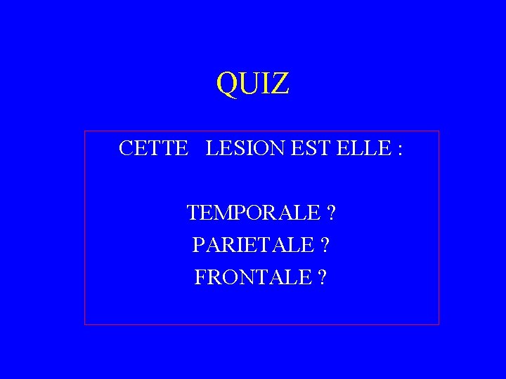 QUIZ CETTE LESION EST ELLE : TEMPORALE ? PARIETALE ? FRONTALE ? 