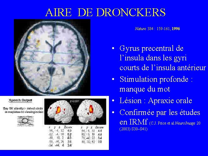 AIRE DE DRONCKERS Nature 384 : 159 -161, 1996 • Gyrus precentral de l’insula