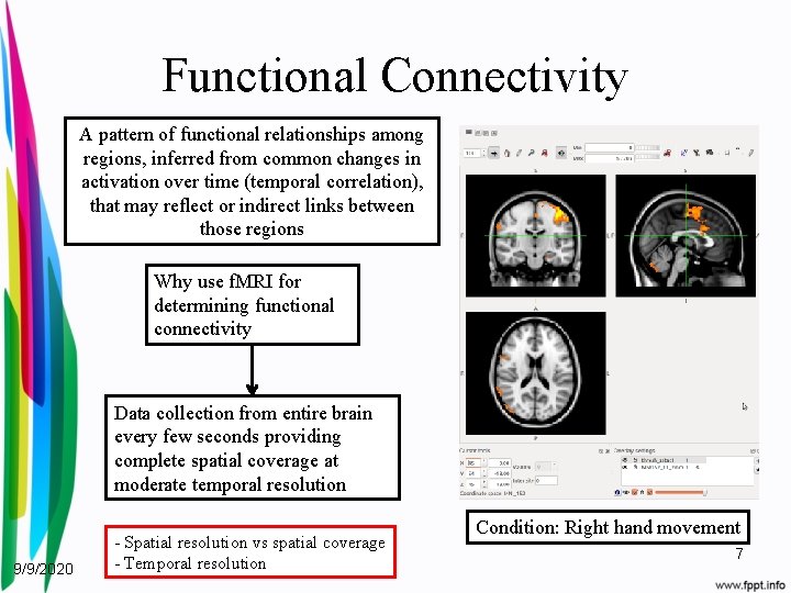 Functional Connectivity A pattern of functional relationships among regions, inferred from common changes in