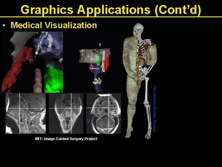 Graphics Applications (Cont’d) • Medical Visualization The Visible Human Project MIT: Image-Guided Surgery Project