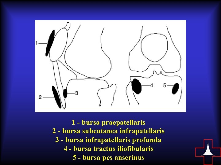 1 - bursa praepatellaris 2 - bursa subcutanea infrapatellaris 3 - bursa infrapatellaris profunda