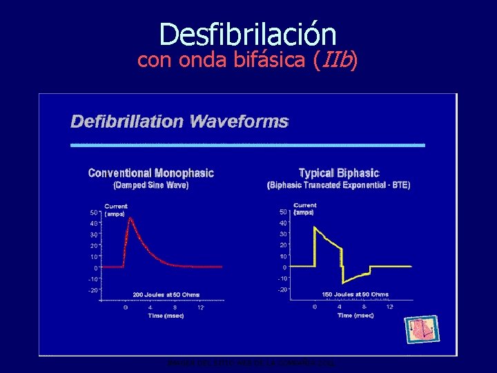 Desfibrilación con onda bifásica (IIb) IMAGEN DEL SITIO WEB DE LA COMPAÑÍA ZOLL 