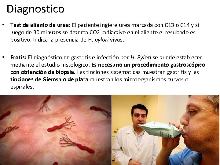 Diagnostico • Test de aliento de urea: El paciente ingiere urea marcada con C