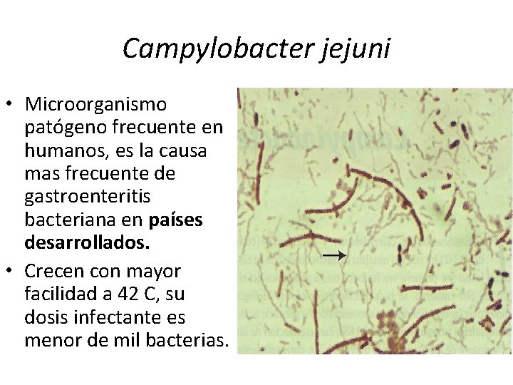 Campylobacter jejuni • Microorganismo patógeno frecuente en humanos, es la causa mas frecuente de