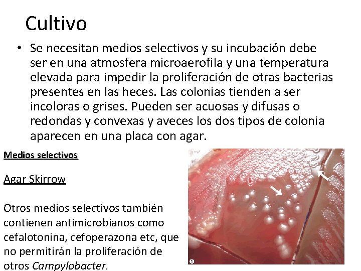 Cultivo • Se necesitan medios selectivos y su incubación debe ser en una atmosfera