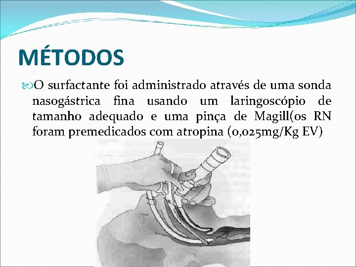 MÉTODOS O surfactante foi administrado através de uma sonda nasogástrica fina usando um laringoscópio