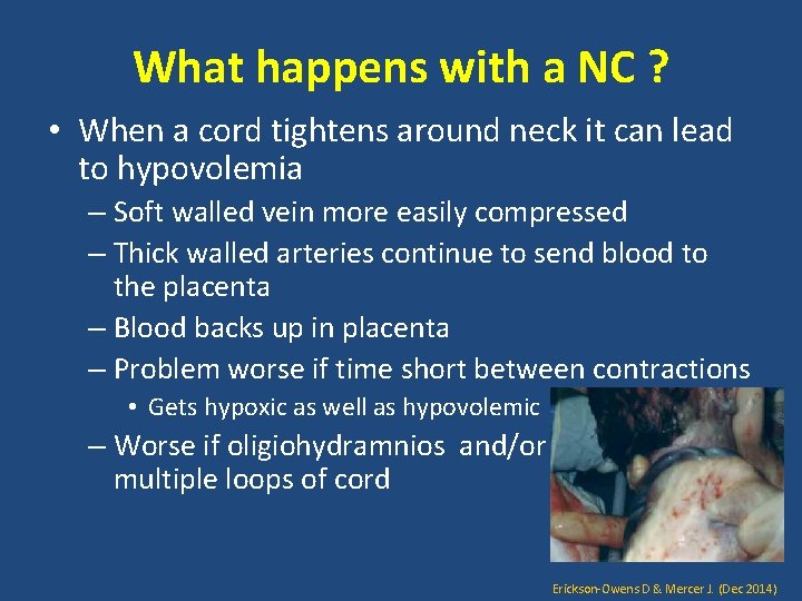 What happens with a NC ? • When a cord tightens around neck it