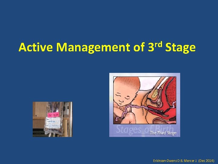 Active Management of rd 3 Stage Erickson-Owens D & Mercer J. (Dec 2014) 