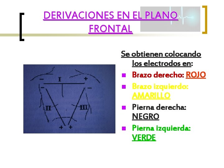 DERIVACIONES EN EL PLANO FRONTAL Se obtienen colocando los electrodos en: n Brazo derecho: