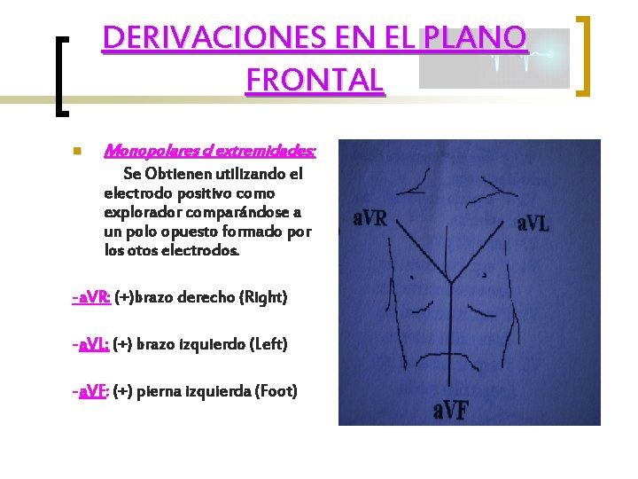 DERIVACIONES EN EL PLANO FRONTAL n Monopolares d extremidades: Se Obtienen utilizando el electrodo