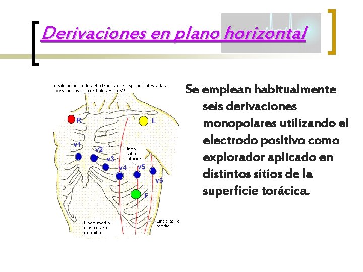 Derivaciones en plano horizontal Se emplean habitualmente seis derivaciones monopolares utilizando el electrodo positivo