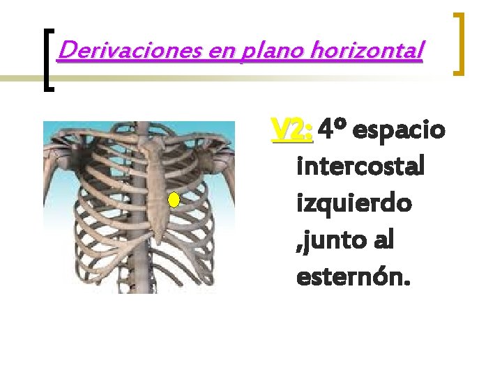 Derivaciones en plano horizontal V 2: 4º espacio intercostal izquierdo , junto al esternón.