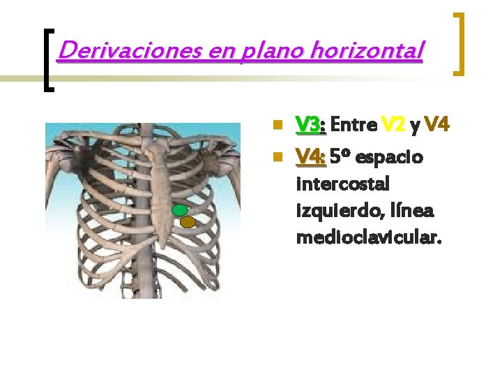 Derivaciones en plano horizontal n n V 3: Entre V 2 y V 4: