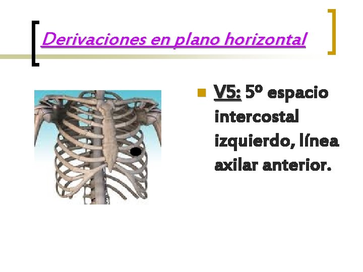 Derivaciones en plano horizontal n V 5: 5º espacio intercostal izquierdo, línea axilar anterior.