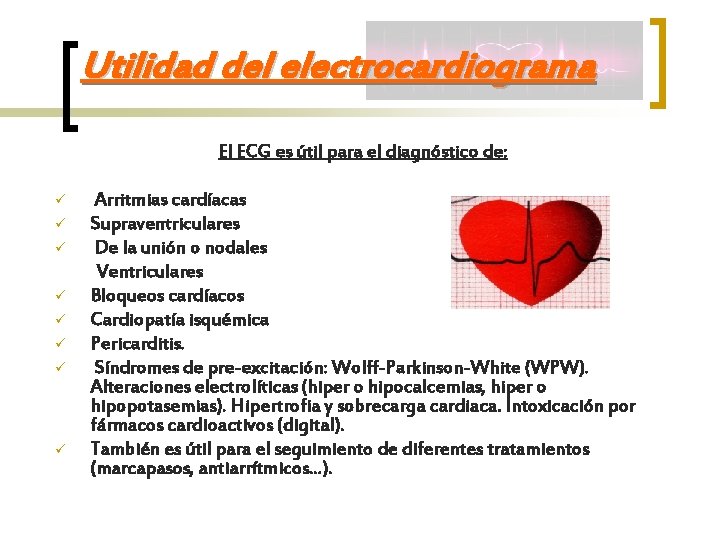 Utilidad del electrocardiograma El ECG es útil para el diagnóstico de: ü ü ü