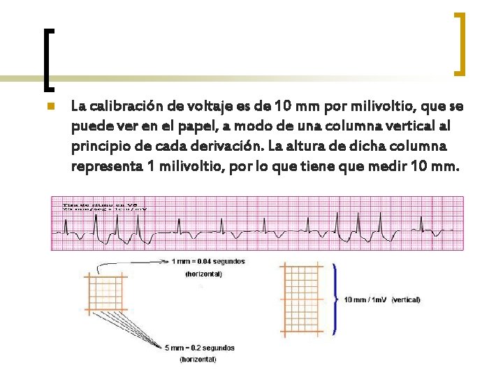 n La calibración de voltaje es de 10 mm por milivoltio, que se puede