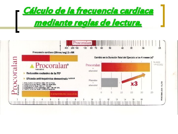 Cálculo de la frecuencia cardiaca mediante reglas de lectura. 
