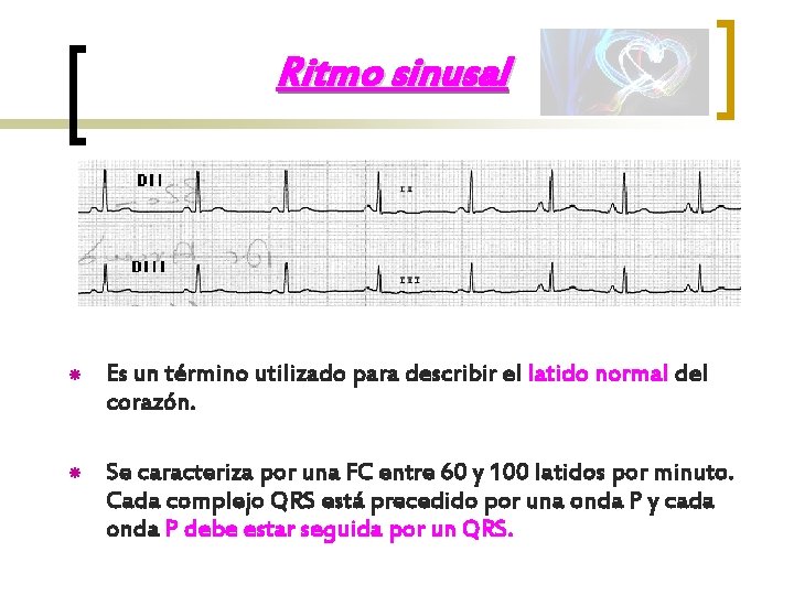 Ritmo sinusal Es un término utilizado para describir el latido normal del corazón. Se