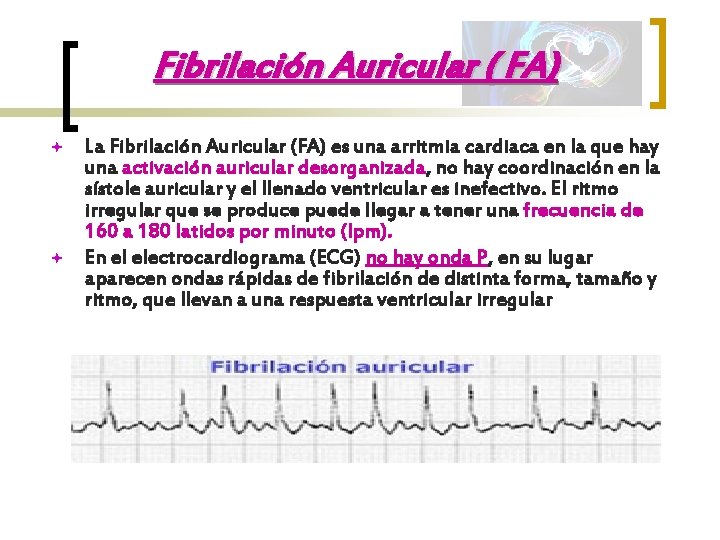 Fibrilación Auricular ( FA) ª ª La Fibrilación Auricular (FA) es una arritmia cardiaca