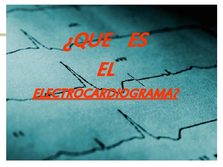 ¿QUE ES EL ELECTROCARDIOGRAMA? 