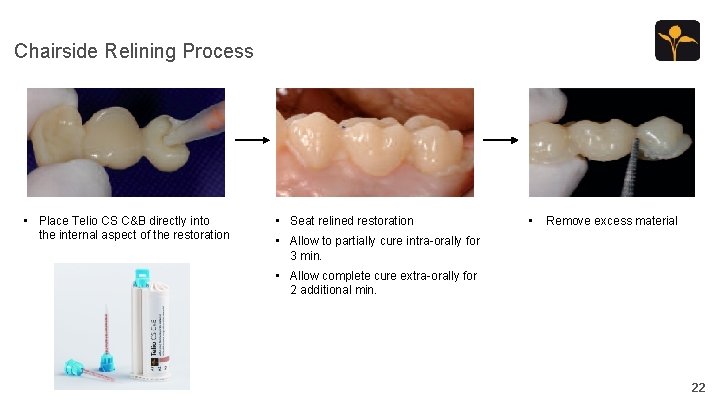 Chairside Relining Process • Place Telio CS C&B directly into the internal aspect of