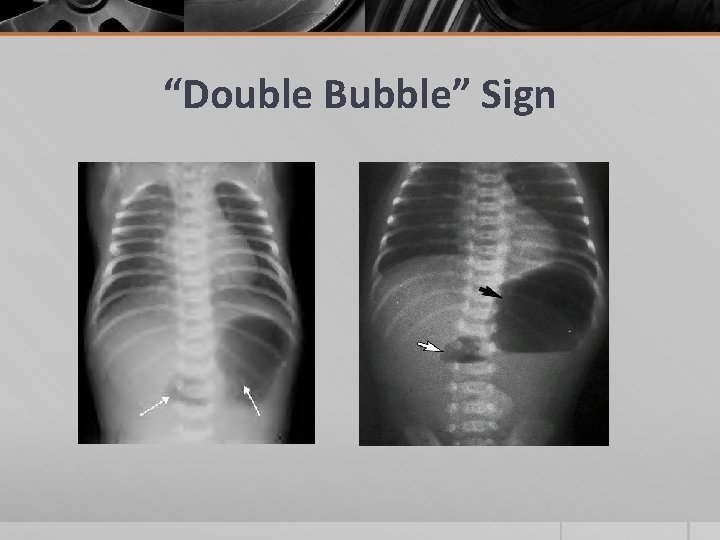 “Double Bubble” Sign 