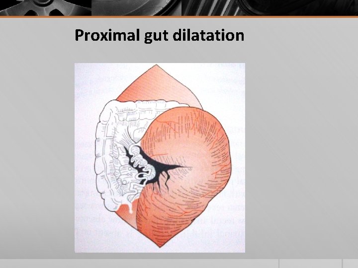 Proximal gut dilatation 