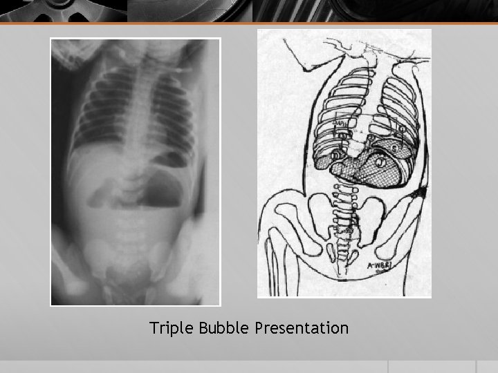 Triple Bubble Presentation 