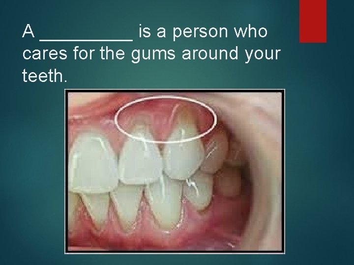 A _____ is a person who cares for the gums around your teeth. 