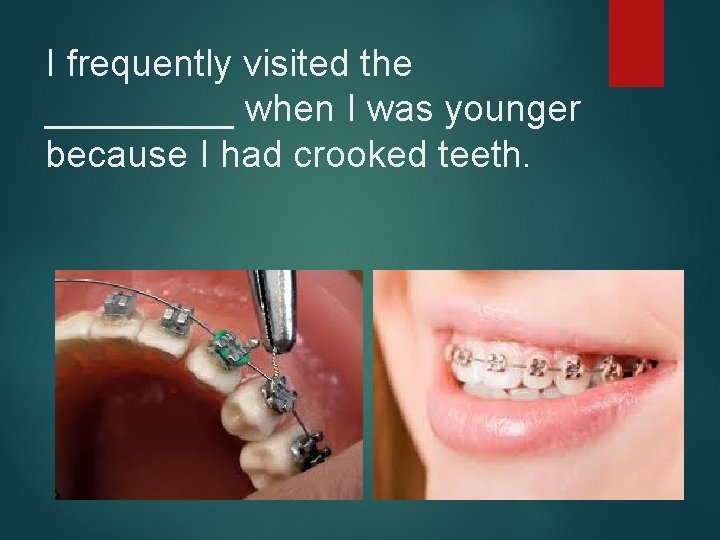 I frequently visited the _____ when I was younger because I had crooked teeth.