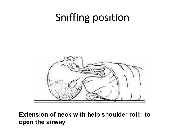 Sniffing position Extension of neck with help shoulder roll: : to open the airway