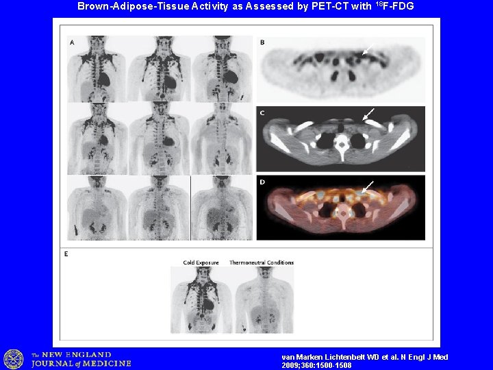 Brown-Adipose-Tissue Activity as Assessed by PET-CT with 18 F-FDG van Marken Lichtenbelt WD et