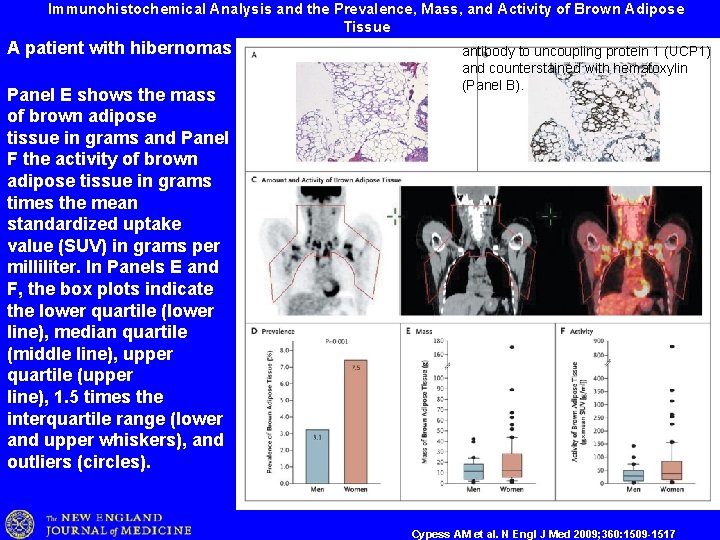 Immunohistochemical Analysis and the Prevalence, Mass, and Activity of Brown Adipose Tissue A patient