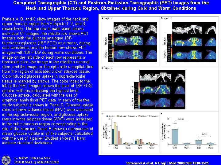 Computed Tomographic (CT) and Positron-Emission Tomographic (PET) Images from the Neck and Upper Thoracic