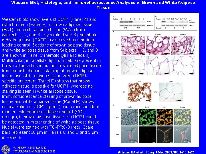 Western Blot, Histologic, and Immunofluorescence Analyses of Brown and White Adipose Tissue Western blots