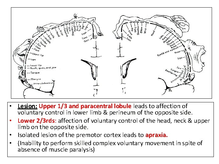  • Lesion: Upper 1/3 and paracentral lobule leads to affection of voluntary control