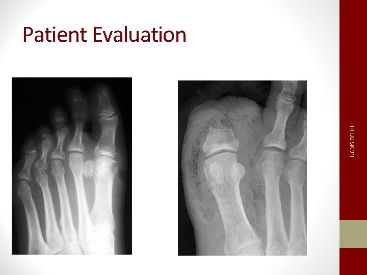 UCMS DELHI Patient Evaluation 