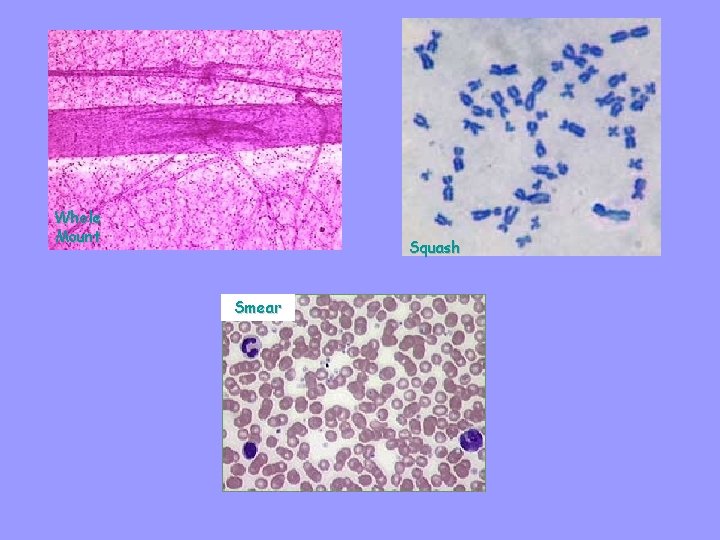 Whole Mount Squash Smear 