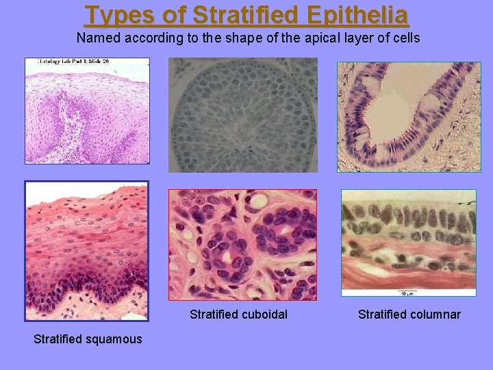 Types of Stratified Epithelia Named according to the shape of the apical layer of