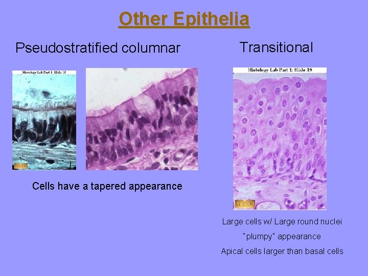 Other Epithelia Pseudostratified columnar Transitional Cells have a tapered appearance Large cells w/ Large