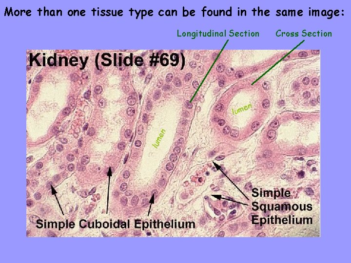 More than one tissue type can be found in the same image: Longitudinal Section