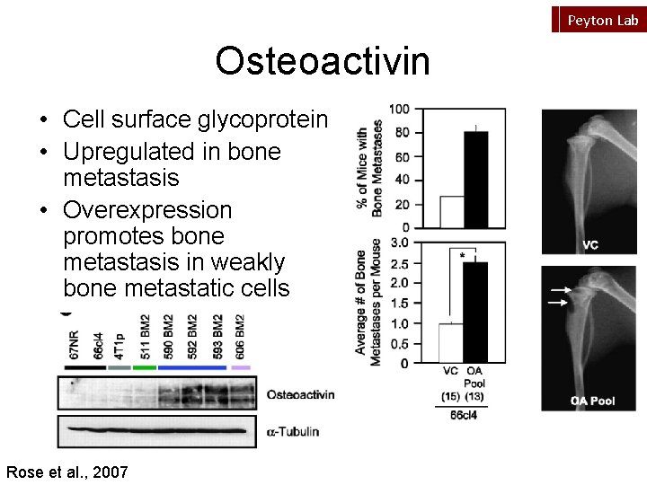 Peyton Lab Osteoactivin • Cell surface glycoprotein • Upregulated in bone metastasis • Overexpression