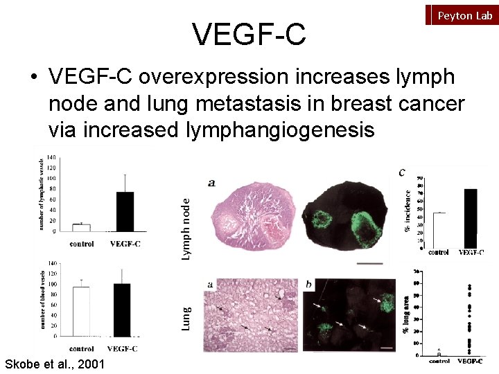 VEGF-C Peyton Lab Lung Lymph node • VEGF-C overexpression increases lymph node and lung