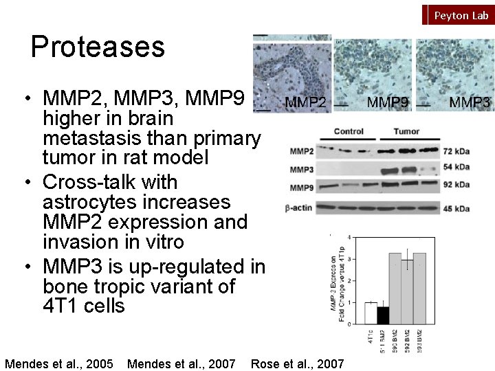 Peyton Lab Proteases • MMP 2, MMP 3, MMP 9 higher in brain metastasis