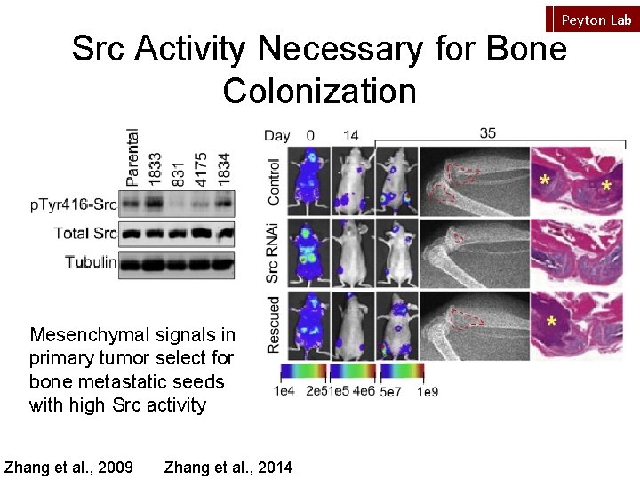 Peyton Lab Src Activity Necessary for Bone Colonization Mesenchymal signals in primary tumor select