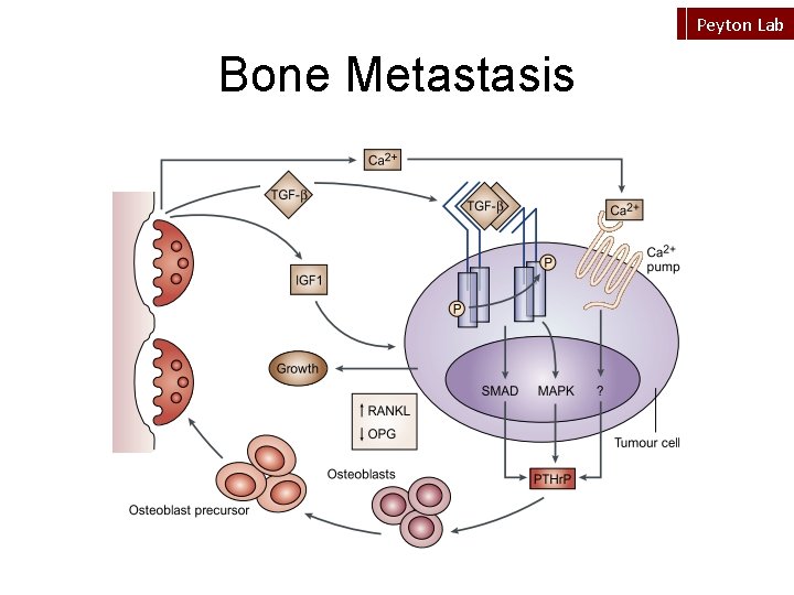 Peyton Lab Bone Metastasis 