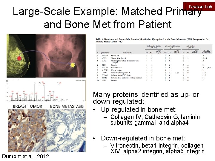 Peyton Lab Large-Scale Example: Matched Primary and Bone Met from Patient Many proteins identified